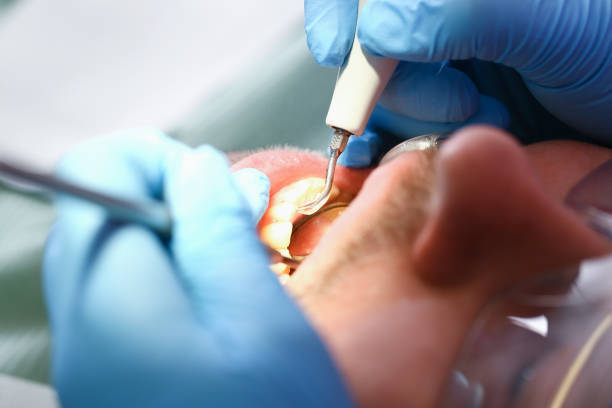 Best Broken or Chipped Tooth Repair in Laymantown, VA