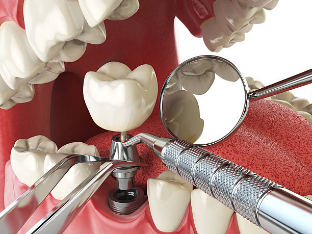 Best Emergency Treatment for Oral Infections in Laymantown, VA