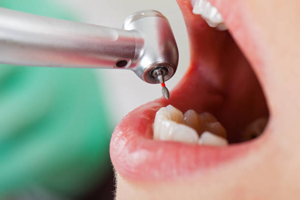 Best Dental Abscess Treatment in Laymantown, VA